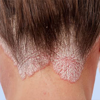 Best dermatologist in Pune